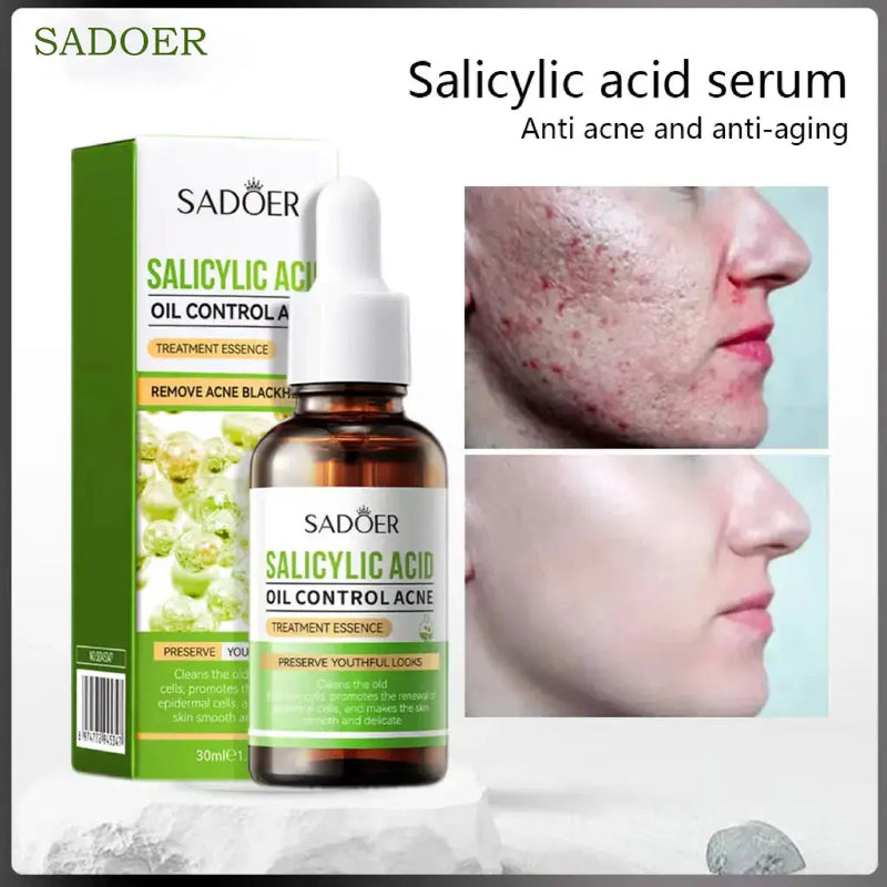 Poppy Gifts Skin Care Sadoer Salicylic Acid Oil Control Treatment Essence 30ml Sadoer Salicylic Acid Oil Control Treatment Essence 30ml