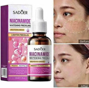 Poppy Gifts Skin Care Sadoer Niacinamide Brightening Essence 30ml Skin Brightening Serum Sadoer Niacinamide Brightening Essence 30ml Serum