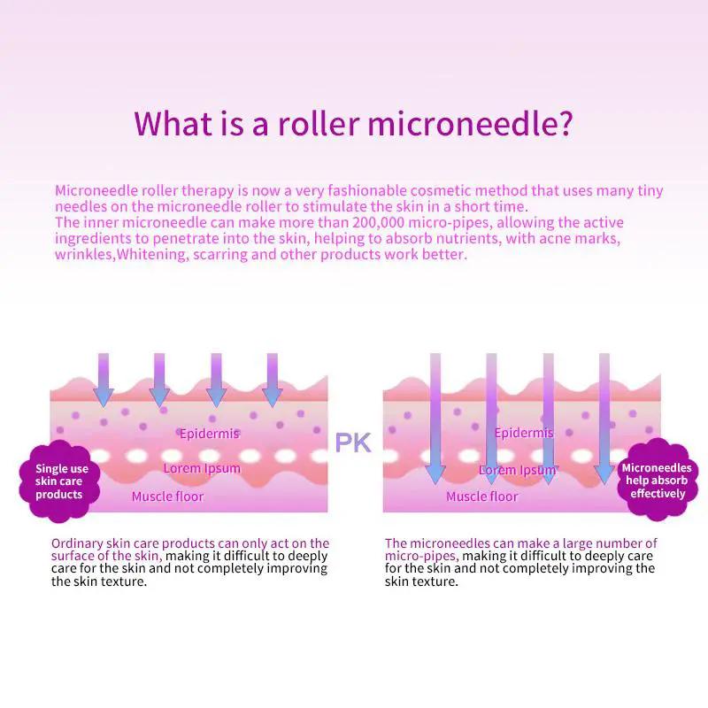 540 Microneedle Scar Derma Roller 0.3mm by salelink.co.nz