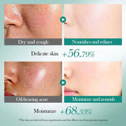 BIOAQUA Hyaluronic Acid Moisturizing Repair Facial Skin Care 6-piece Set by Poppy Gifts