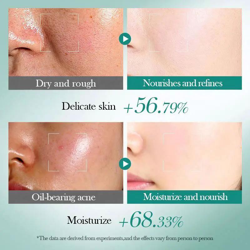 BIOAQUA Hyaluronic Acid Moisturizing Repair Facial Skin Care 6-piece Set by Poppy Gifts