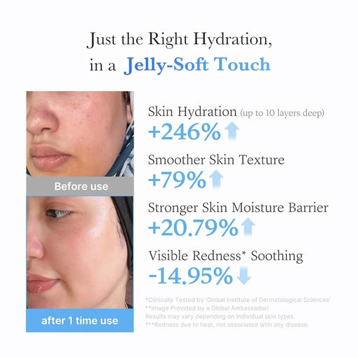 Poppy Gifts Medicube Acid Moisturizing Jelly Cream Medicube Acid Moisturizing Jelly Cream