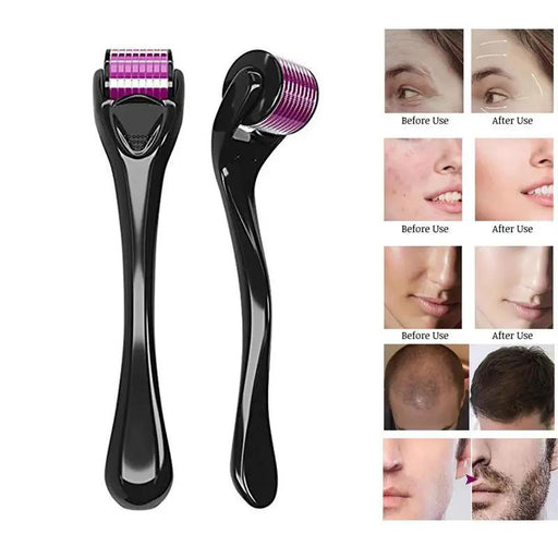 540 Needles Derma Roller 0.75MM by salelink.co.nz