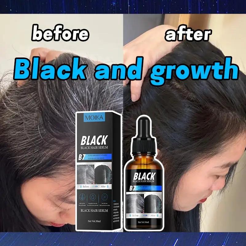 MOIKA Black Hair Serum for Hair Loss 30ml by Poppy Gifts