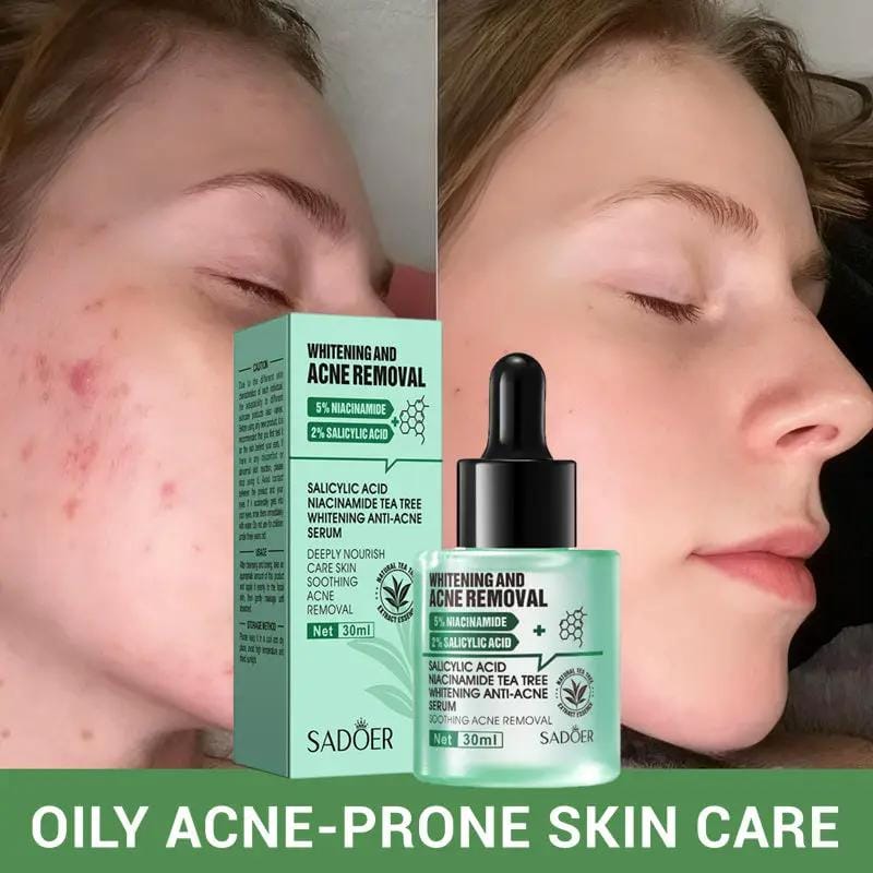 Poppy Gifts Skin Care Sadoer Salicylic Acid Niacinamide Tea Tree Anti Blemish Skincare 5 Piece Set Sadoer Salicylic Acid Niacinamide Tea Tree Set