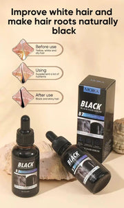 MOIKA Black Hair Serum for Hair Loss 30ml by Poppy Gifts