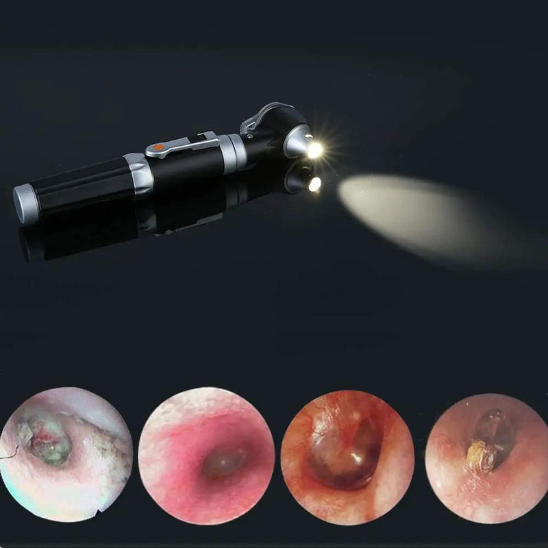 Magnification Diagnostic Ear Scope with LED Direct Illumination Light by salelink.co.nz