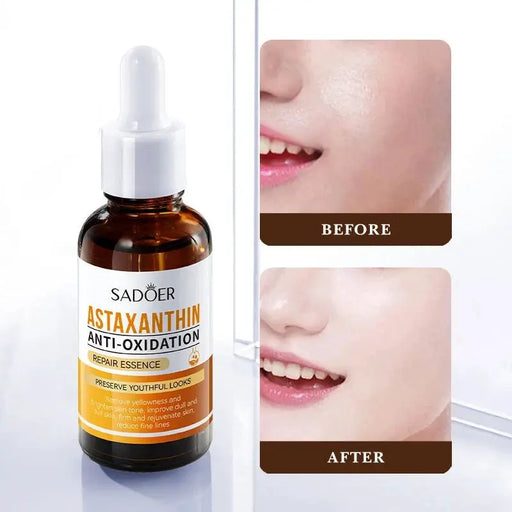 Poppy Gifts Skin Care Sadoer Astaxanthin Anti Oxidation Repair Essence 30ml Facial Serum Sadoer Astaxanthin Anti Oxidation Repair Essence
