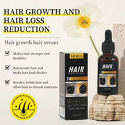 MOIKA Hair Growth Serum for Hair Loss 30ml by Poppy Gifts