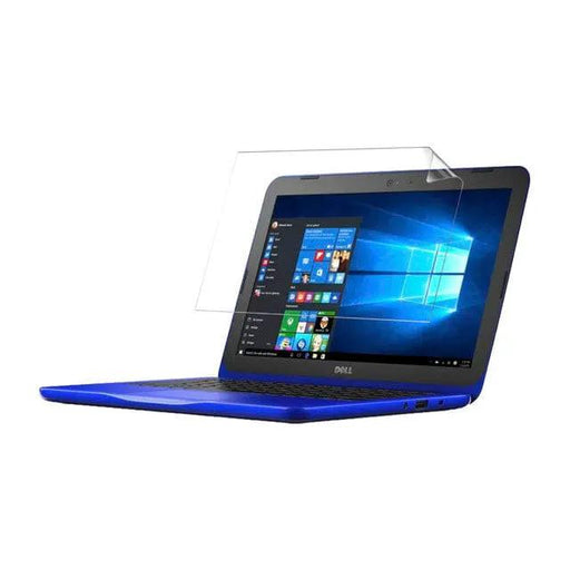 9eight5 Screen protector Hydrogel Screen Protector for Dell Inspiron 11 3162 (Pack of 2) Hydrogel Screen Protector for Dell Inspiron 11 3162 (Pack...