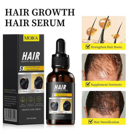 Poppy Gifts Hair MOIKA Hair Growth Serum for Hair Loss 30ml MOIKA Hair Growth Serum for Hair Loss 30ml