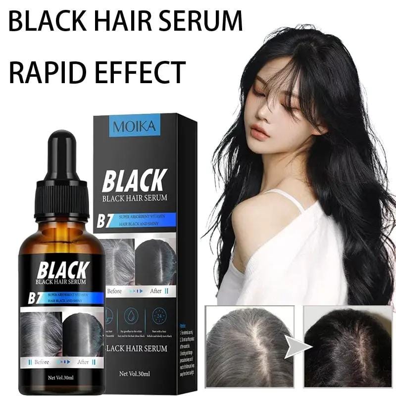 MOIKA Black Hair Serum for Hair Loss 30ml by Poppy Gifts